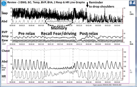 Fig 3 biofeedback relax memory relax